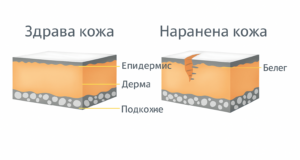 какво е белег